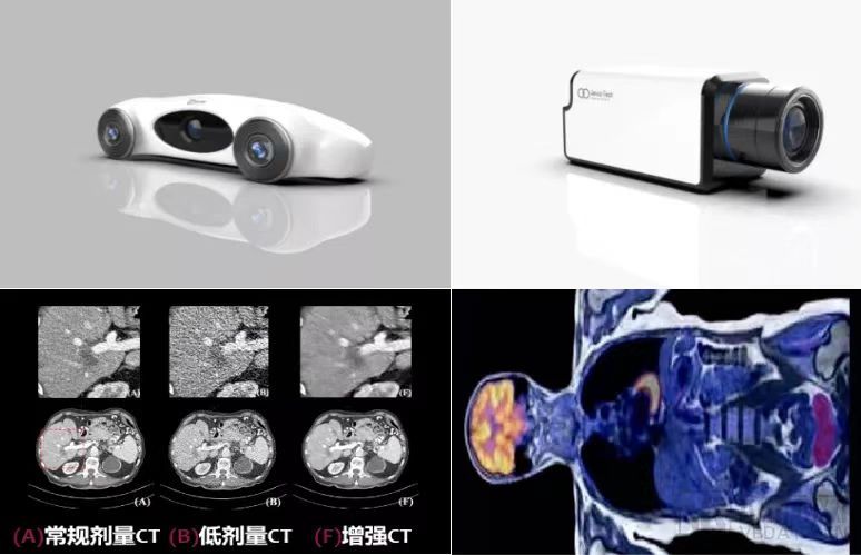 扬奇医芯获数千万元天使轮融资，为放疗设备智能化注入“芯”动能